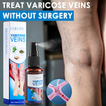 varicose vein spray, leg care spray, circulation support spray, tired leg relief, herbal leg spray, heavy legs treatment, leg comfort spray, body care spray, soothing leg mist, natural leg care